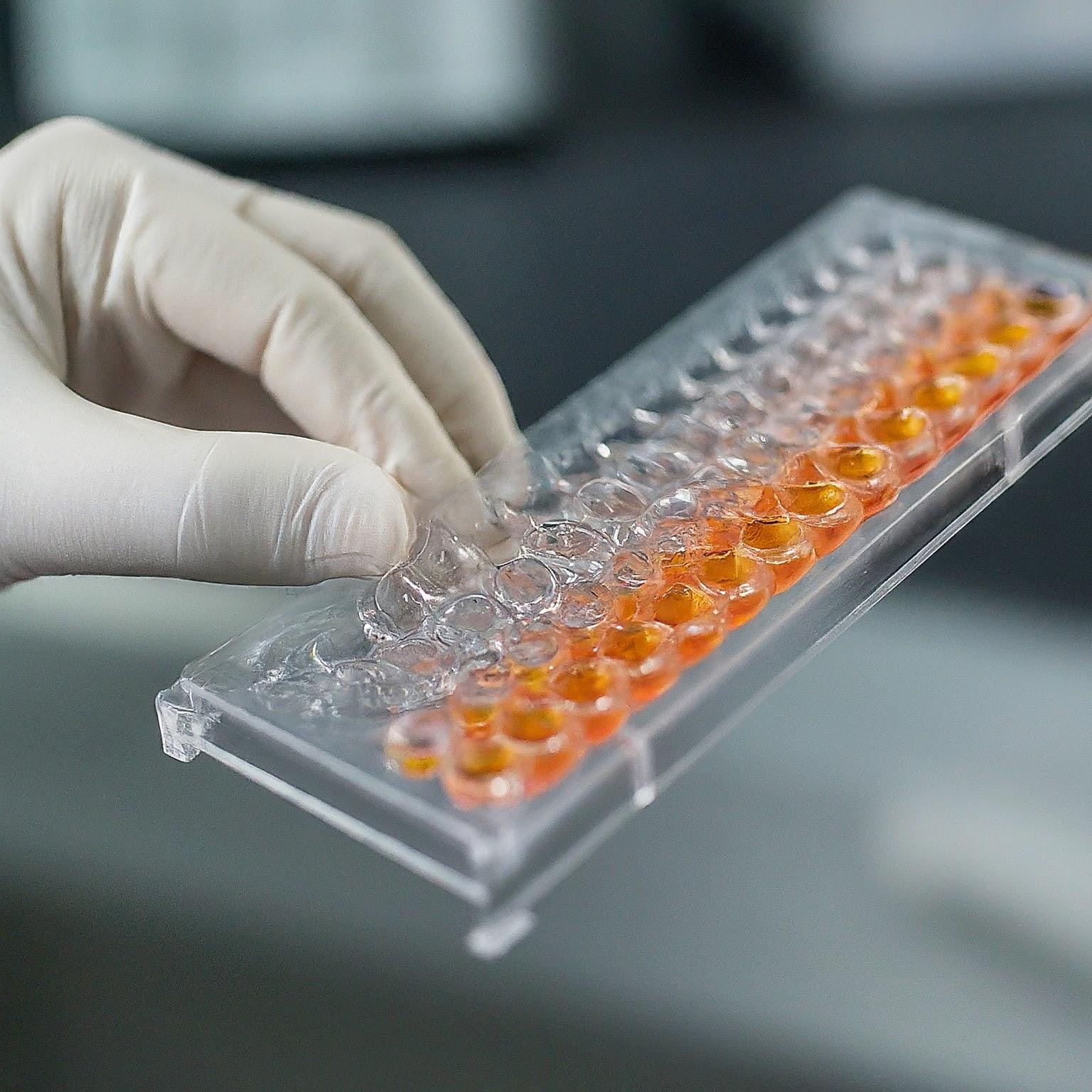 Scientist carefully pipetting a sample into an ELISA plate for cancer testing in a well-equipped laboratory.