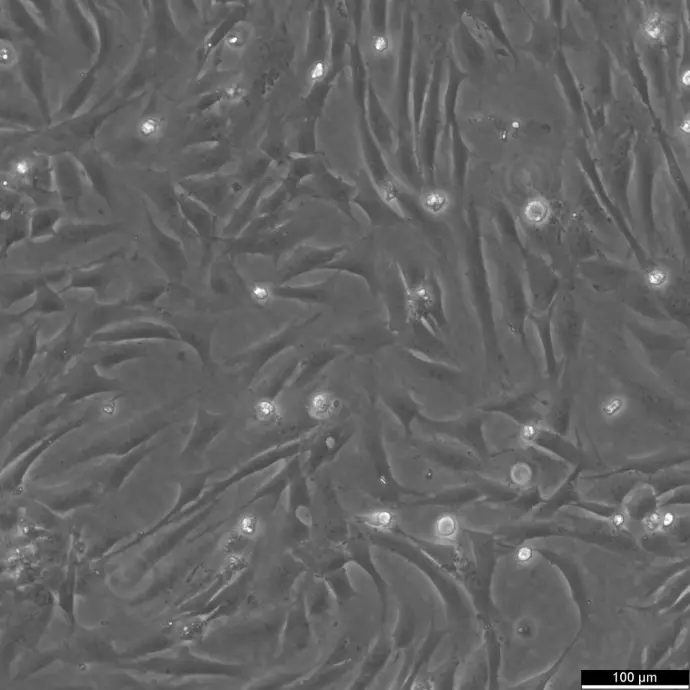 BJ Fibroblast Cells